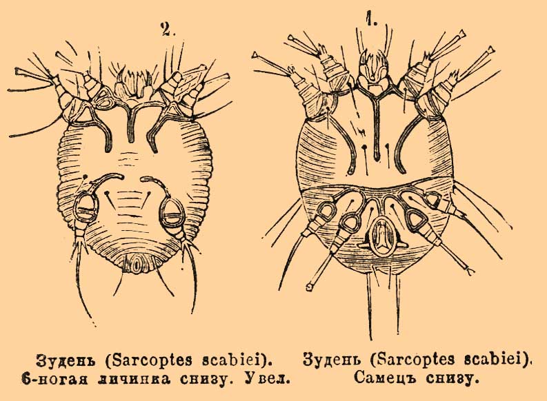 Чесоточный зудень строение рисунок