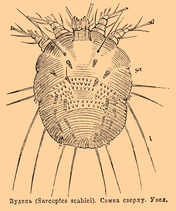 Чесоточный зудень схема