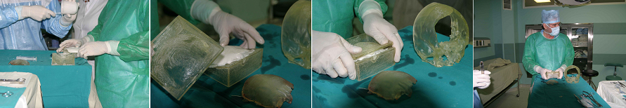 Лазерная стереолитография:Примеры моделей для медицины — ЭНЭ